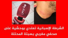 اعتداء الشرطة الإسبانية على صحفي مغربي في سبتة المحتلة.. حين تتحول حرية الصحافة إلى شعار بلا مضمون